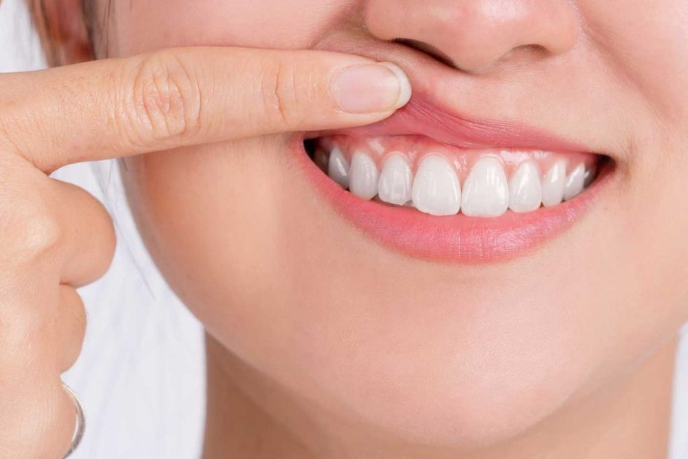 periodoncia-1-1024x1024